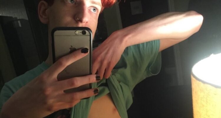 Sunshine Skinny press photo