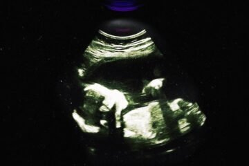 Transmission Project – “Unborn” EP